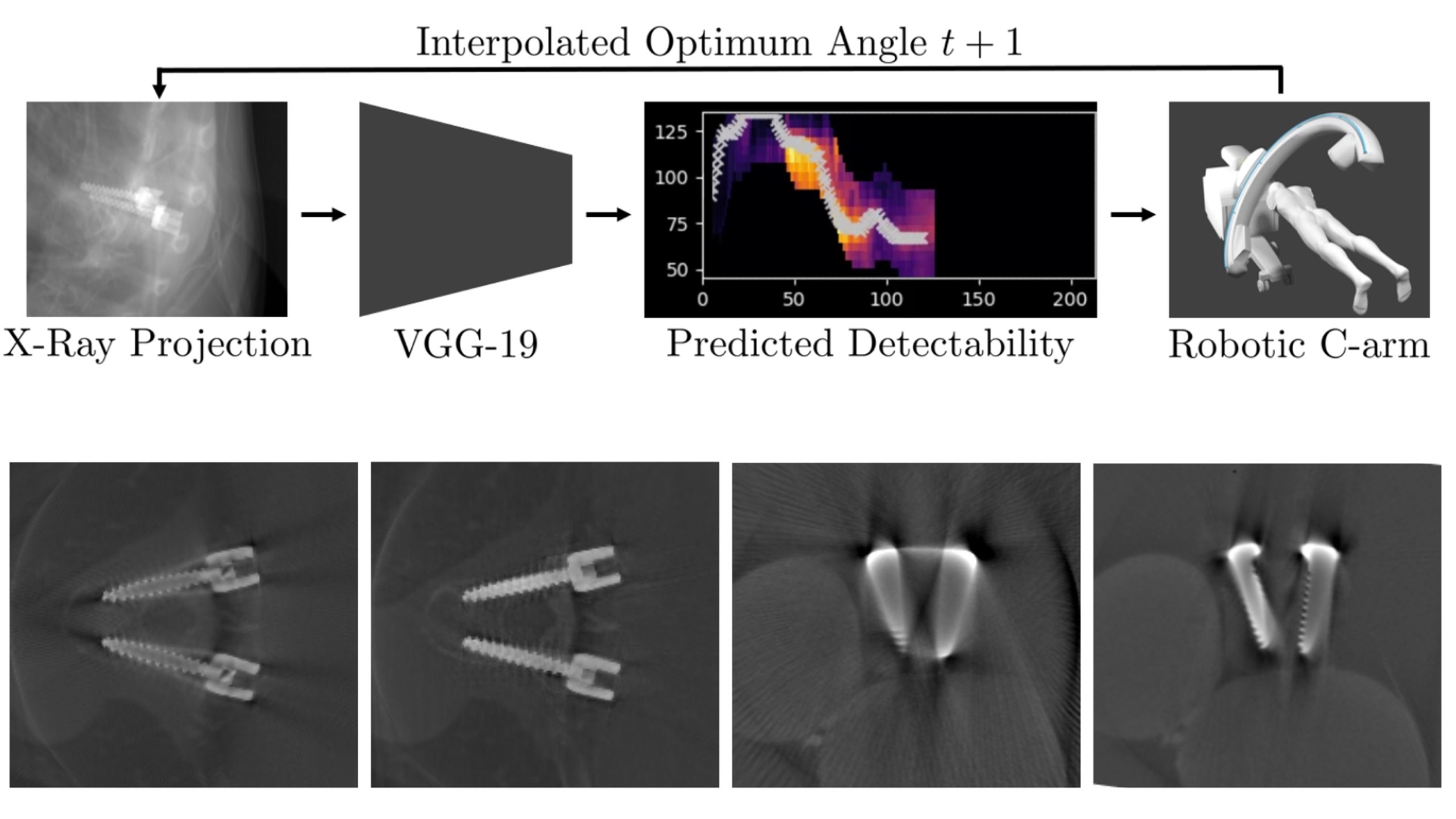 Learning to avoid poor images: Towards task-aware C-arm cone-beam CT trajectories